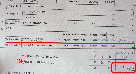 m[XgNjbN̐^lAsu]p,1/6͈:40,000~,2/6͈:90,000~,3/6͈:140,000~,4/6͈:190,000~,5/6͈:240,000~,5/6͈:290,000~